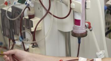 Paliers GGB pour les appareils de dialyse et autres équipements médicaux